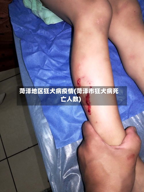 菏泽地区狂犬病疫情(菏泽市狂犬病死亡人数)-第3张图片